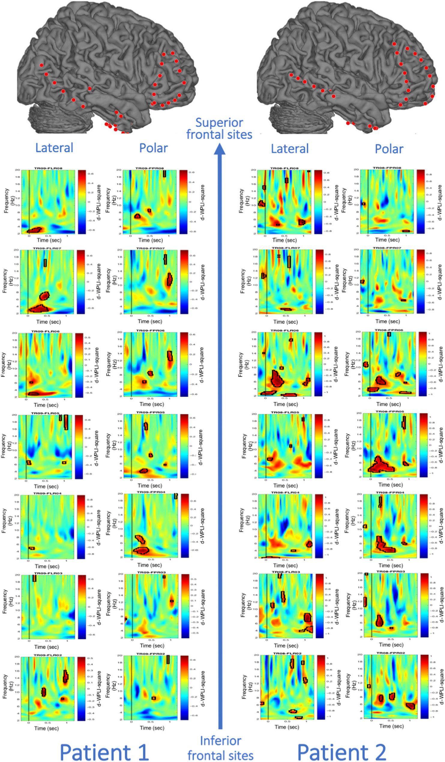 Theta Phase Synchronization between the Human image