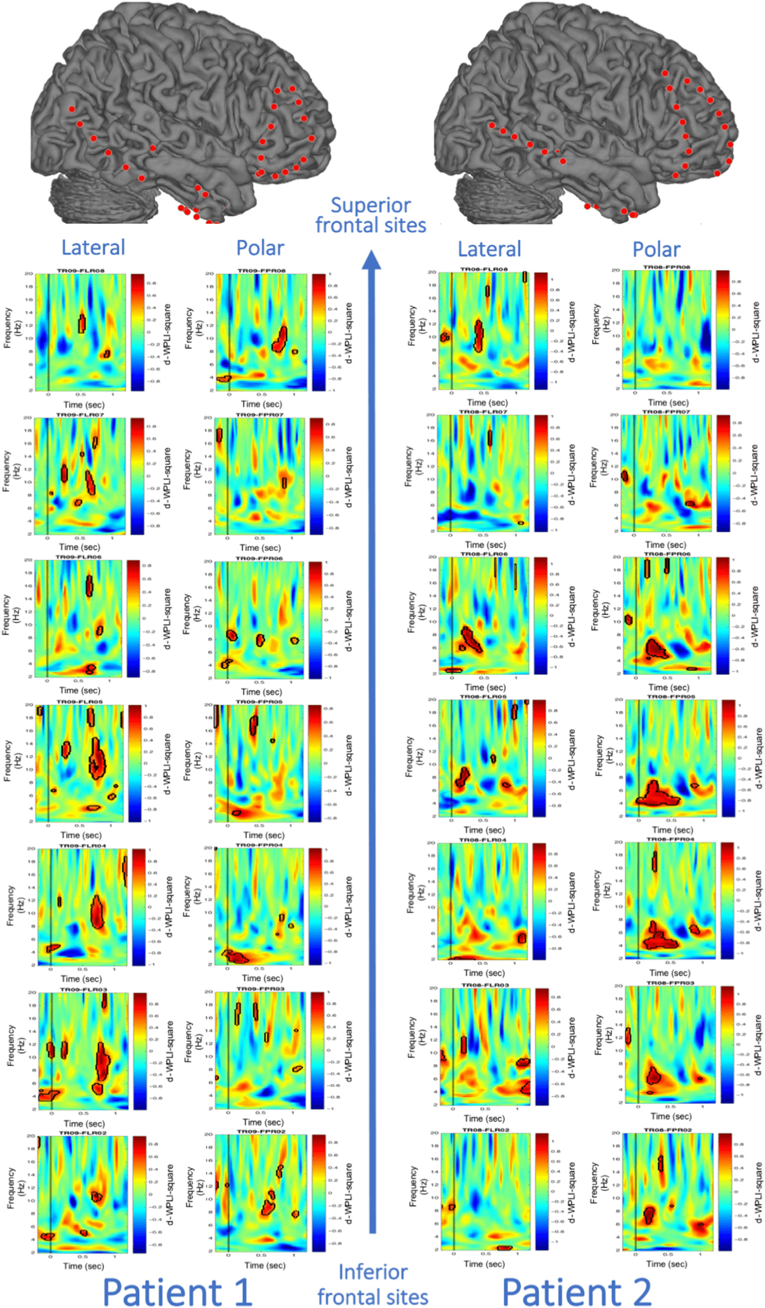 Theta Phase Synchronization between the Human image