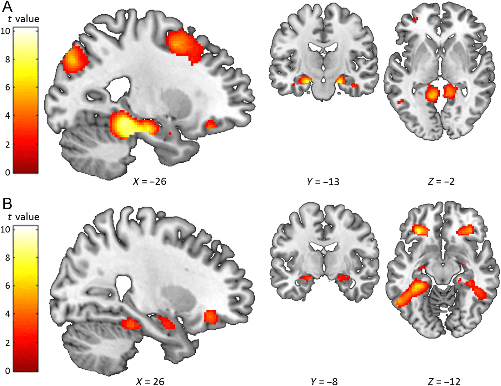 Verbal Paired Associates and the Hippocampus: 图像