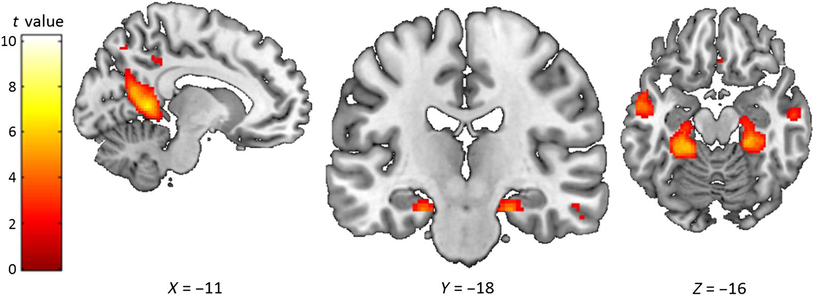 Verbal Paired Associates and the Hippocampus: 图像