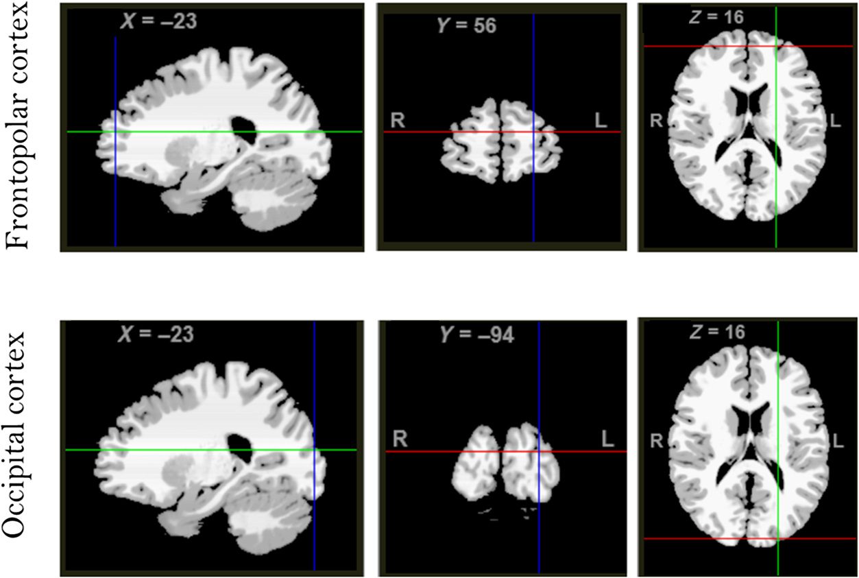 Taking Attention Out of Context: Frontopolar Transcranial image