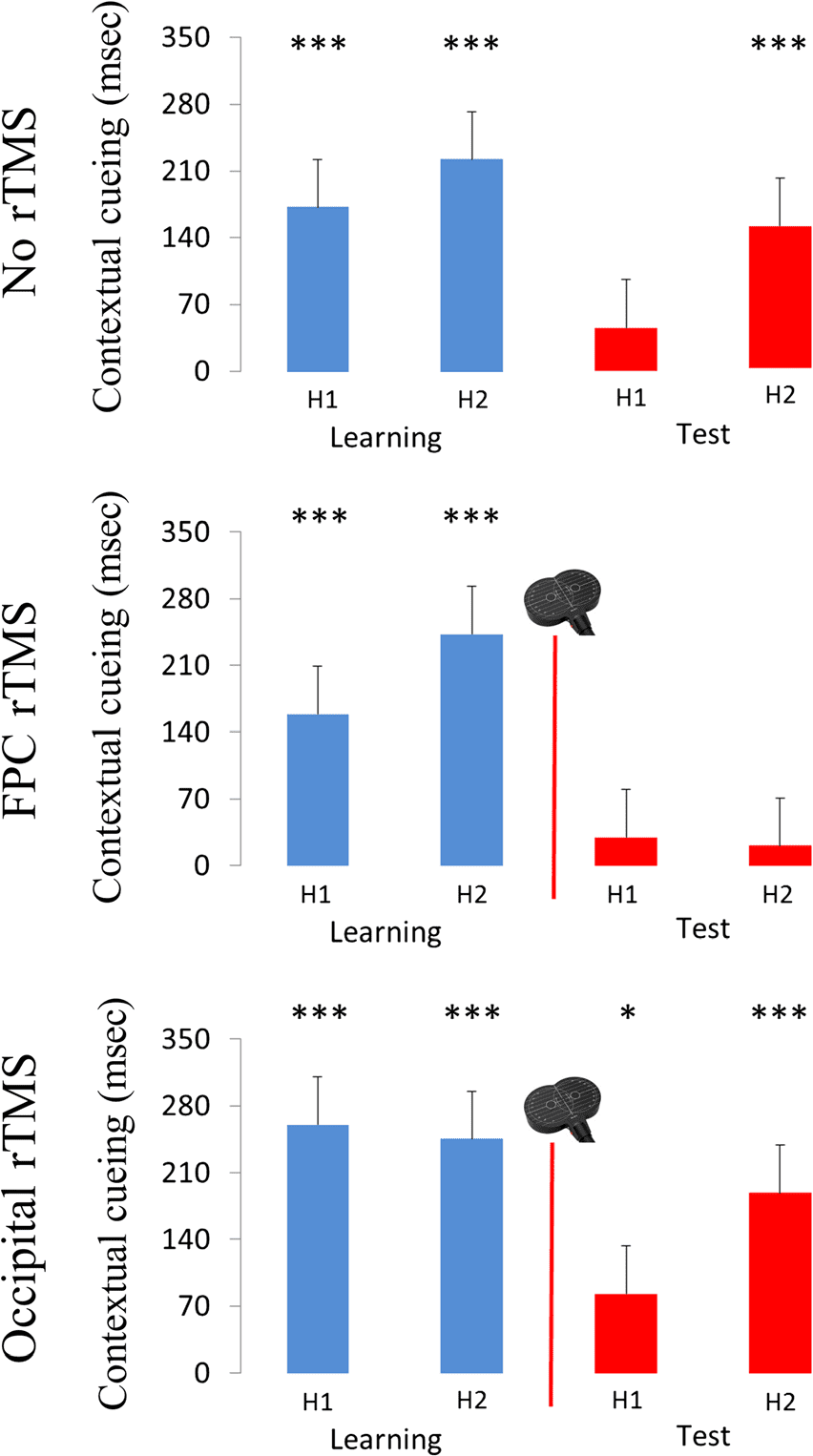 Taking Attention Out of Context: Frontopolar Transcranial image