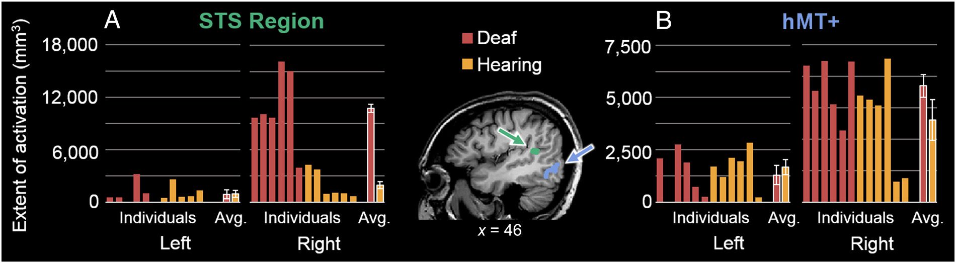 Directional Visual Motion Is Represented in the Auditory image