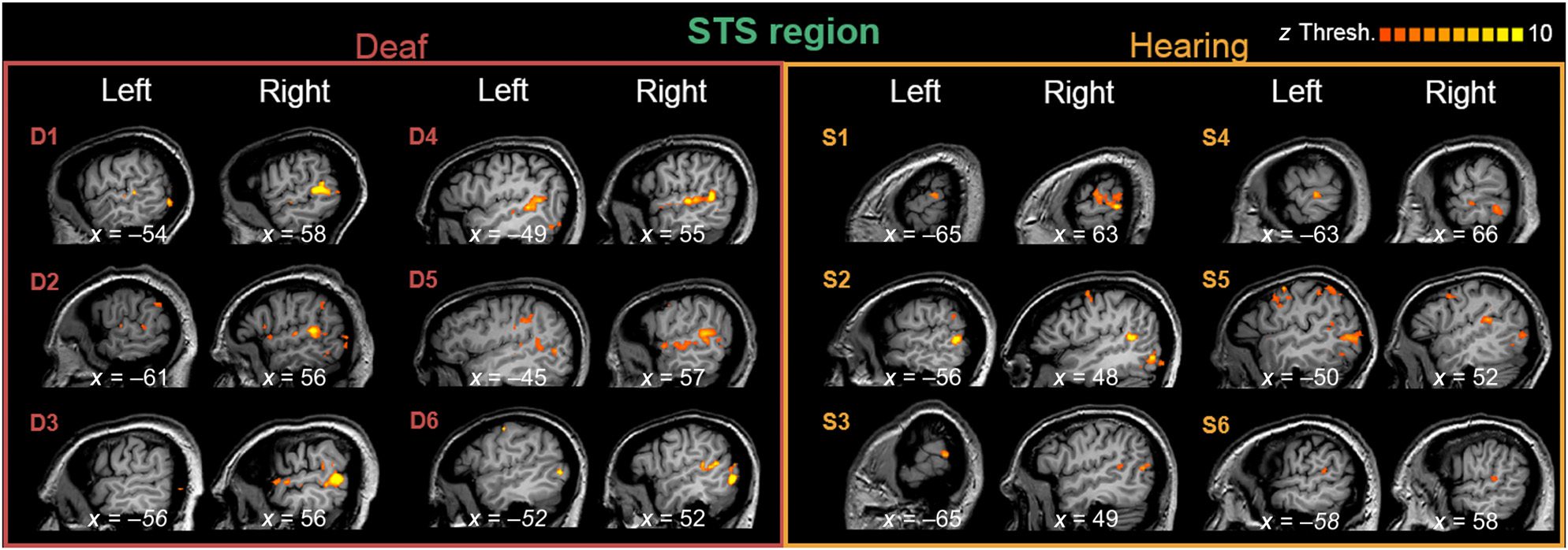 Directional Visual Motion Is Represented in the Auditory image