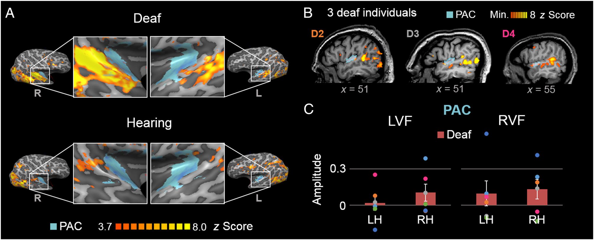 Directional Visual Motion Is Represented in the Auditory image