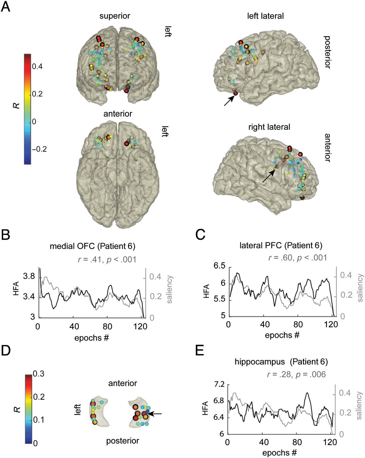 Medial Orbitofrontal Cortex, Dorsolateral Prefrontal image