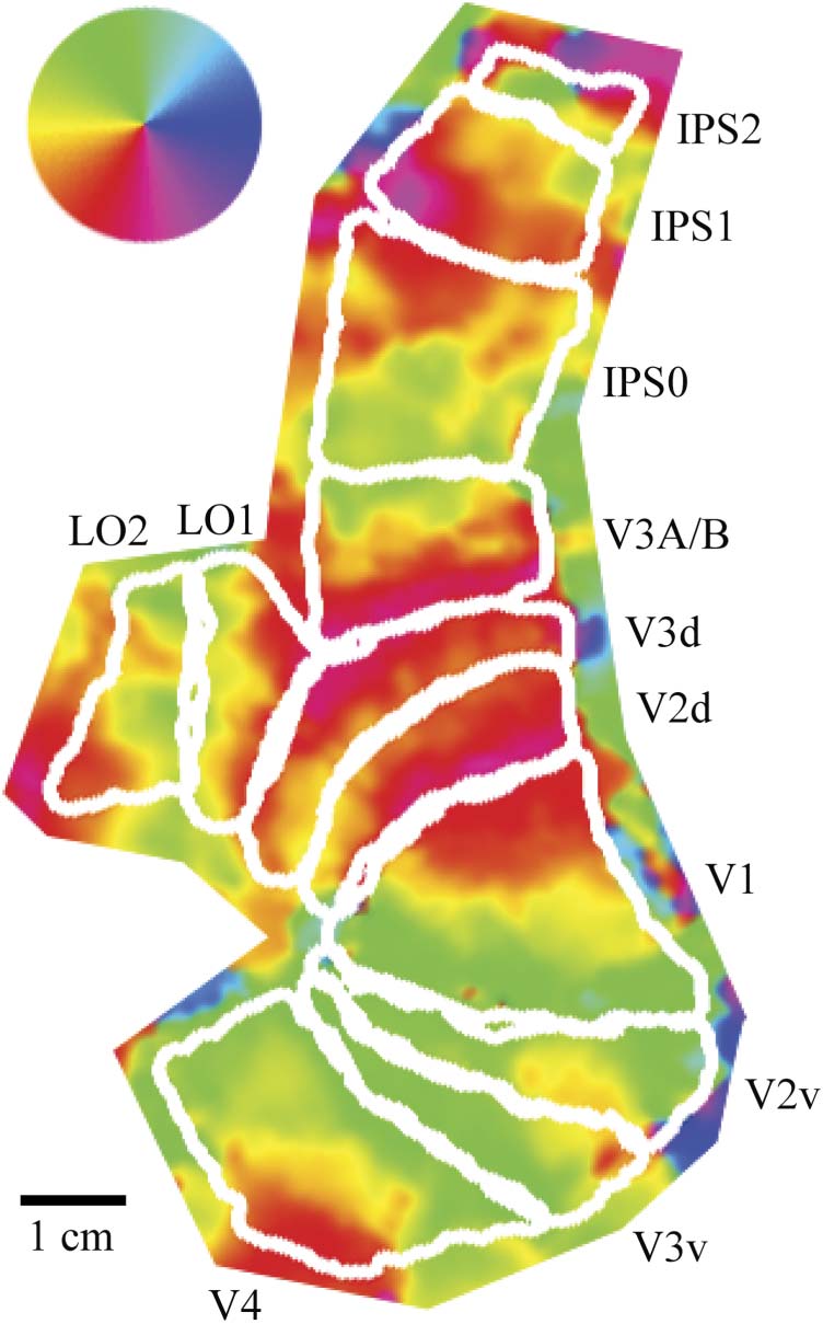 Slow Endogenous Fluctuations in Cortical fMRI image