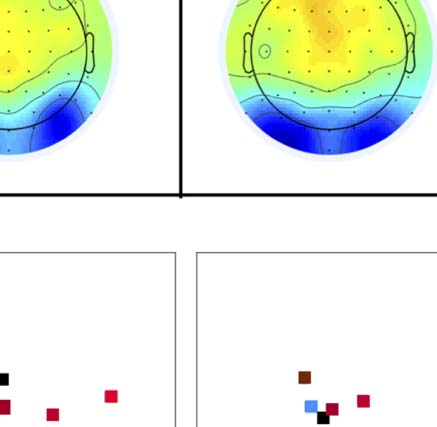 The Formation of Symmetrical Gestalts Is image