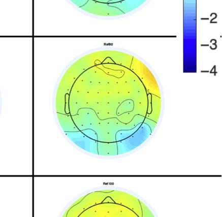 The Formation of Symmetrical Gestalts Is image