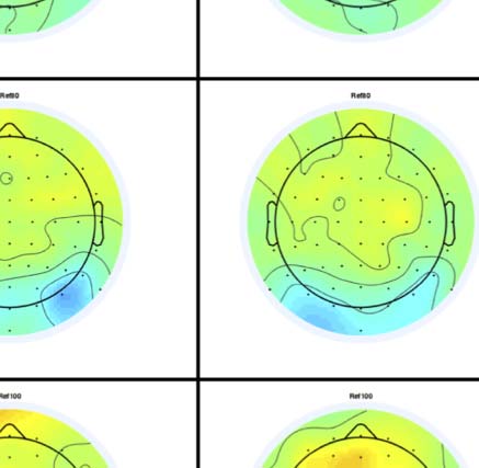 The Formation of Symmetrical Gestalts Is image