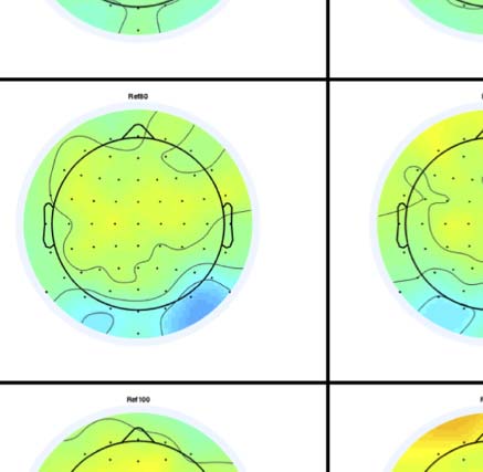 The Formation of Symmetrical Gestalts Is image