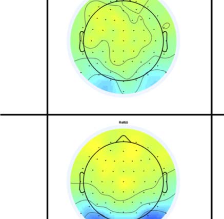 The Formation of Symmetrical Gestalts Is image