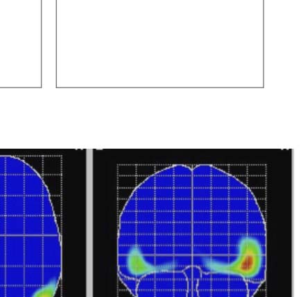 The Formation of Symmetrical Gestalts Is image