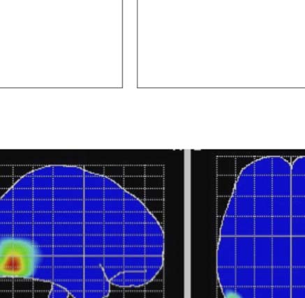 The Formation of Symmetrical Gestalts Is image