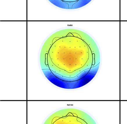 The Formation of Symmetrical Gestalts Is image