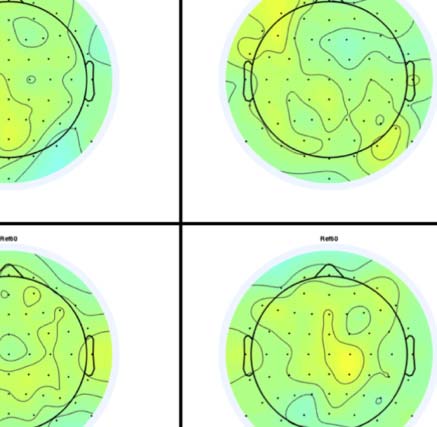 The Formation of Symmetrical Gestalts Is image