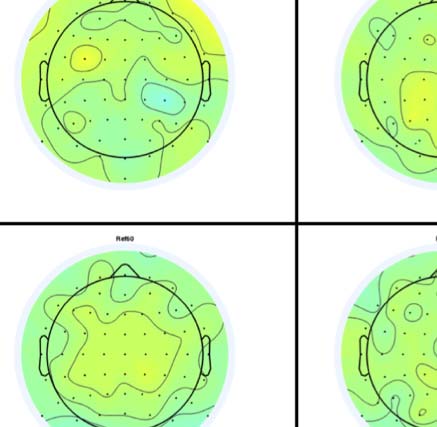 The Formation of Symmetrical Gestalts Is image