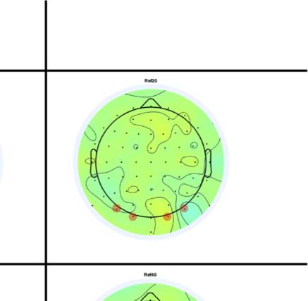 The Formation of Symmetrical Gestalts Is image