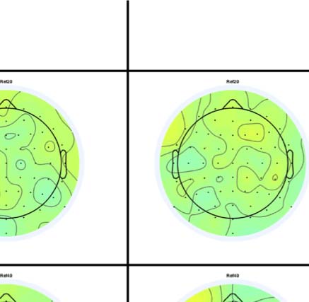 The Formation of Symmetrical Gestalts Is image