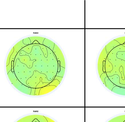 The Formation of Symmetrical Gestalts Is image