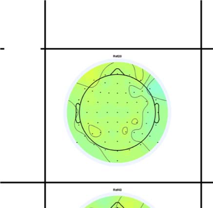 The Formation of Symmetrical Gestalts Is image