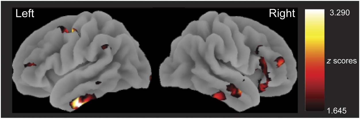 The Neural Time Course of Semantic Ambiguity image