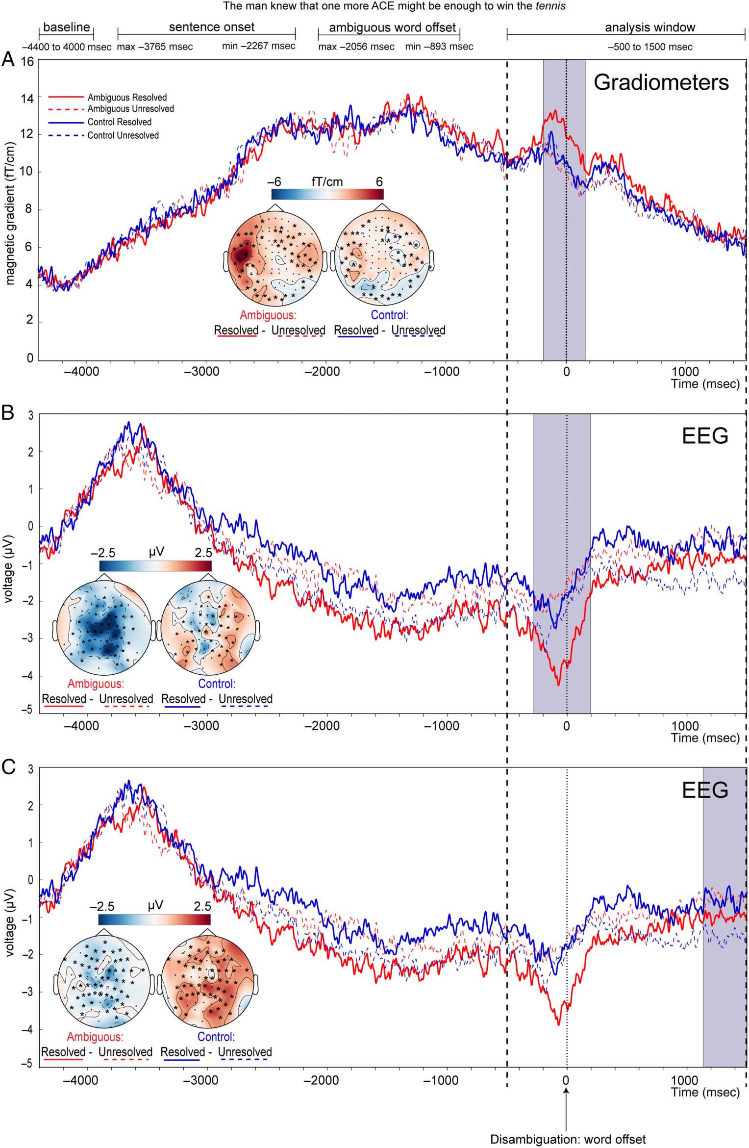 The Neural Time Course of Semantic Ambiguity image