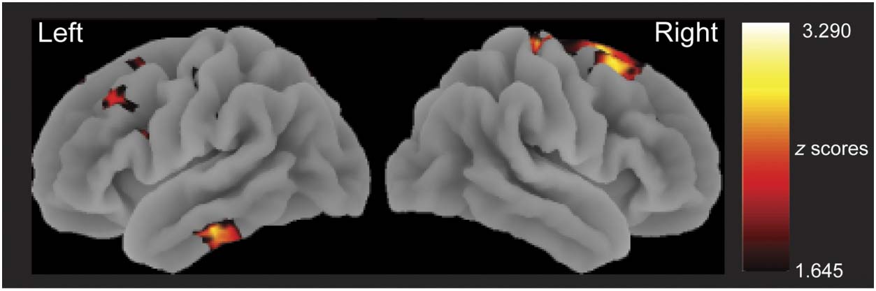 The Neural Time Course of Semantic Ambiguity image