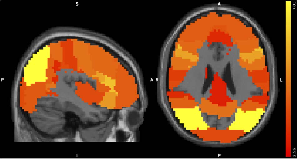 Cortical Transformation of Stimulus Space in Order image