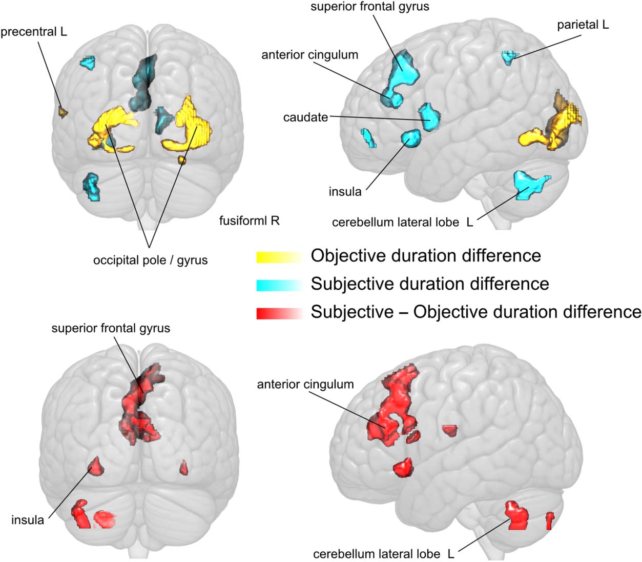 Uncoupling Sensation and Perception in image