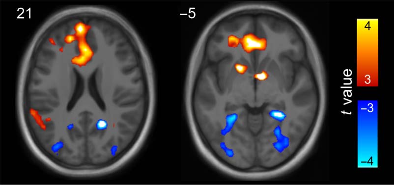 Tracking the Emergence of Location-based Spatial image