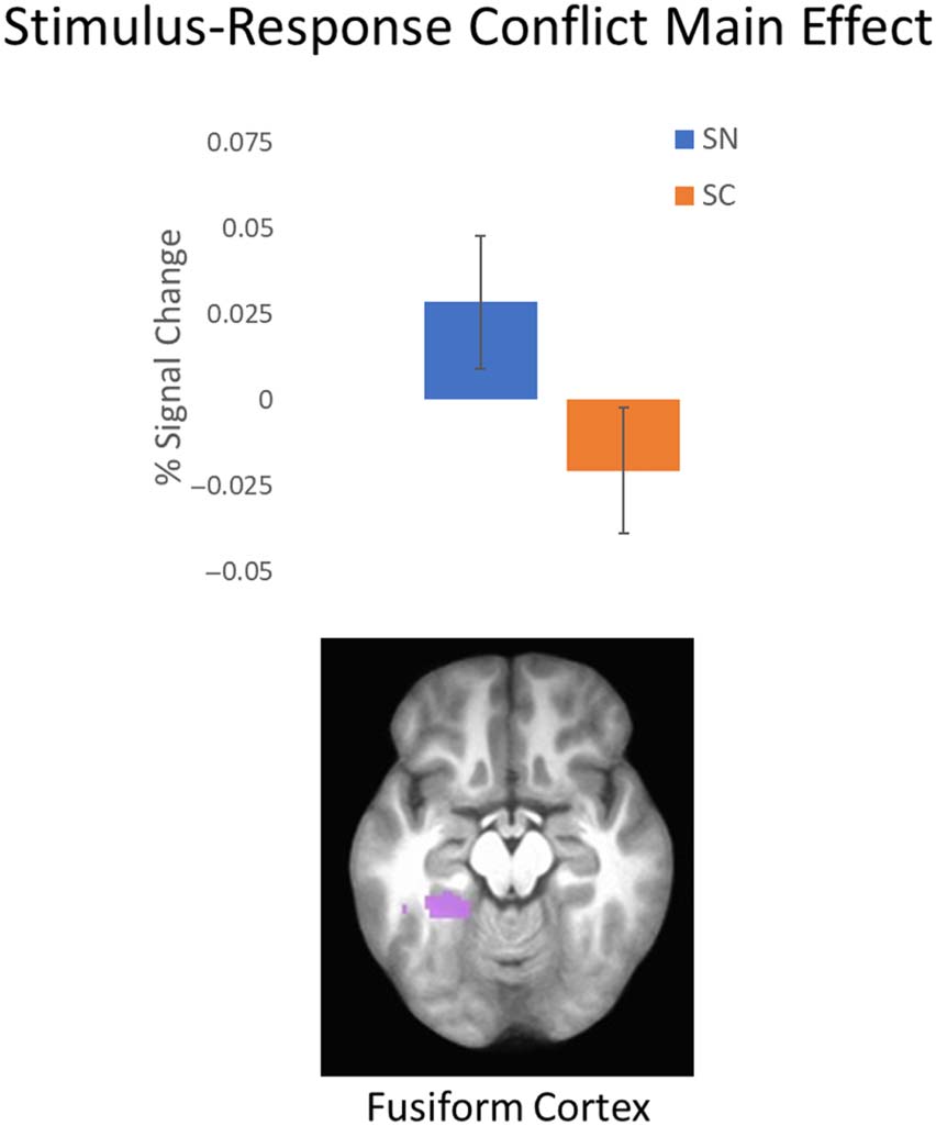 Probing the Neural Systems Underlying Flexible image