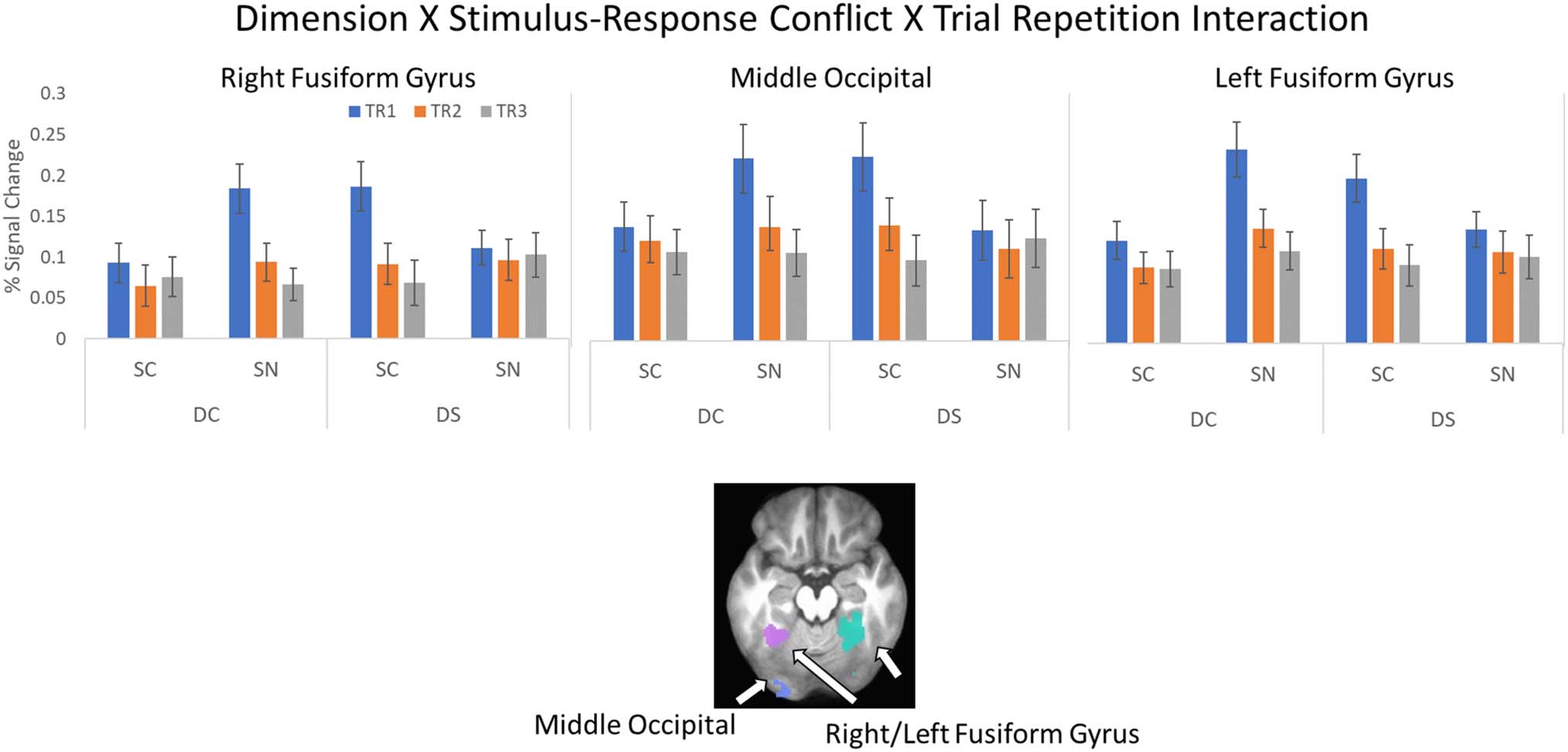 Probing the Neural Systems Underlying Flexible image