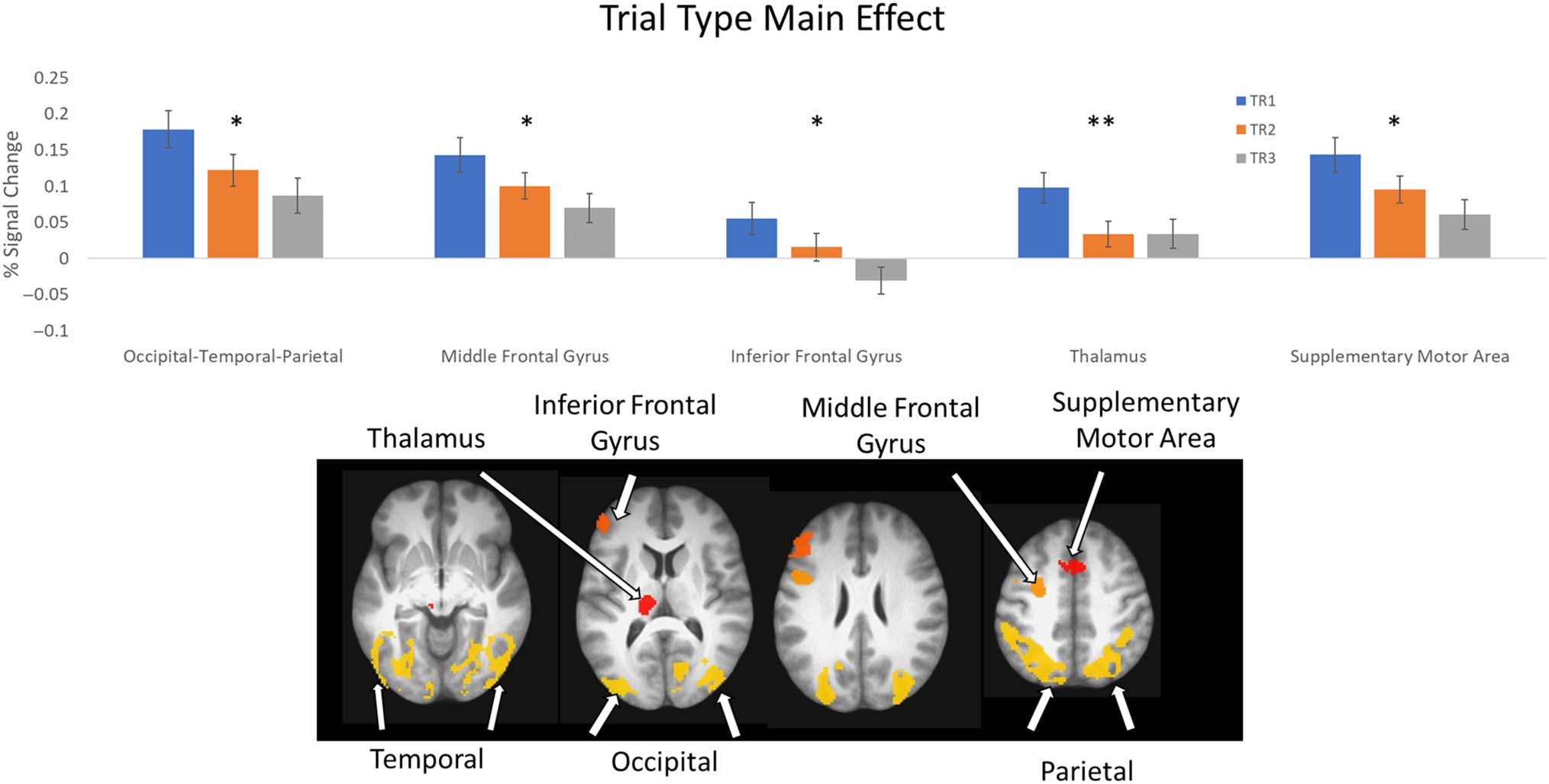 Probing the Neural Systems Underlying Flexible image