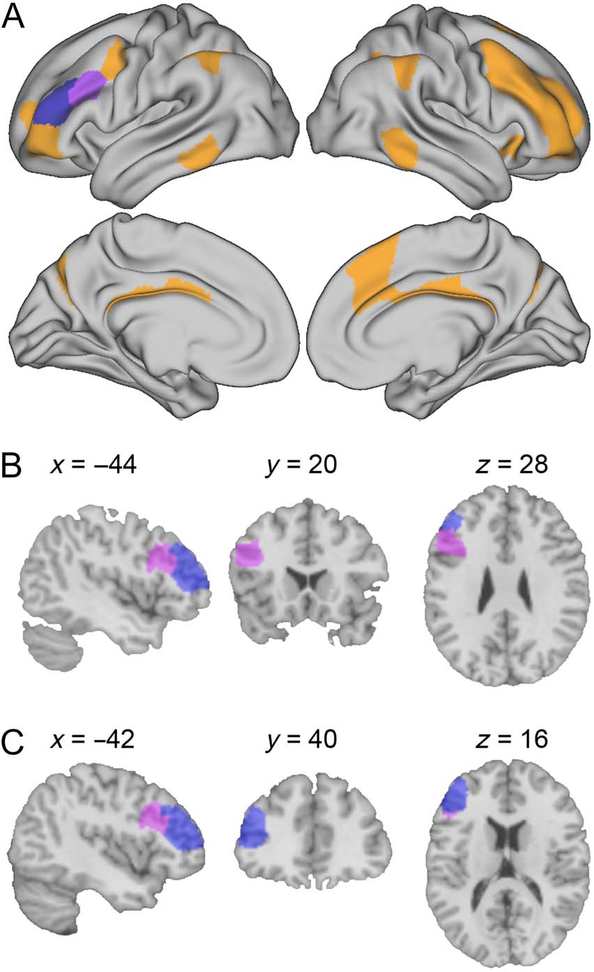 Transcranial Direct Current Stimulation Modulates image