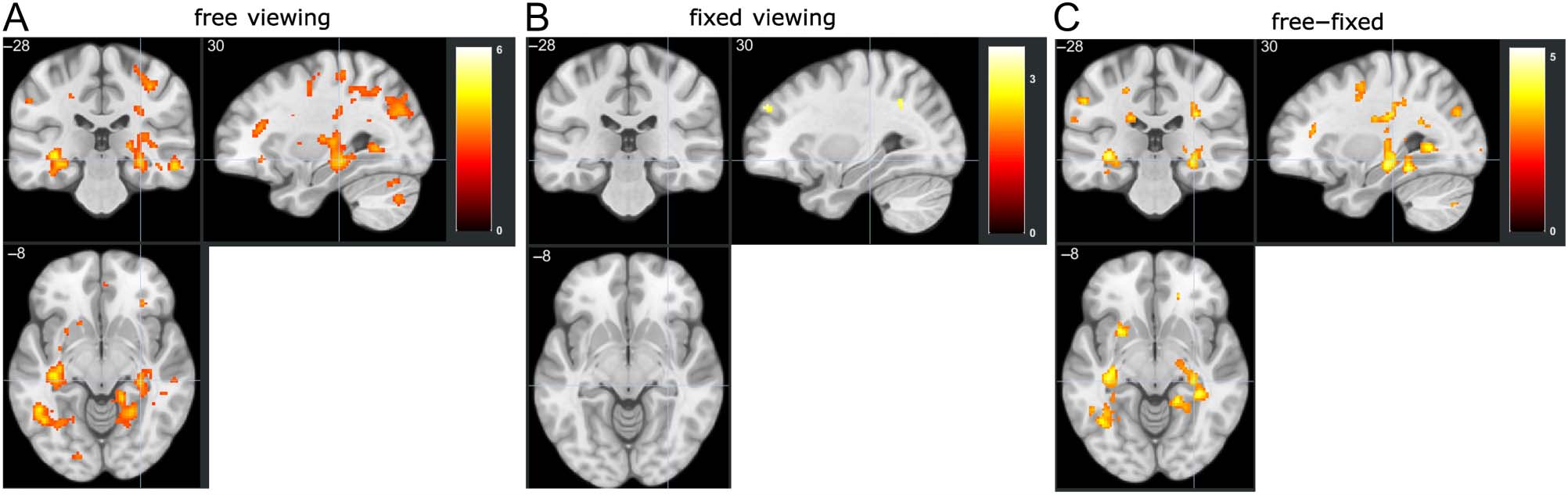 Neural Correlates of Subsequent Memory-Related image