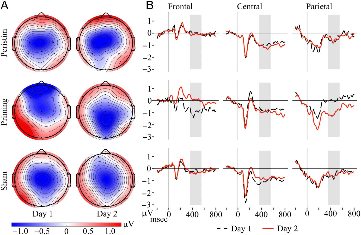 Transcutaneous Auricular Vagus Nerve Stimulation image