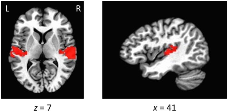 Value-Biased Competition in the image