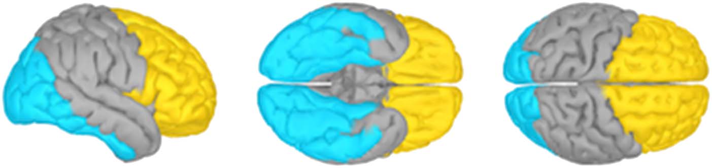 Spatial and Feature-selective Attention Have Distinct, image