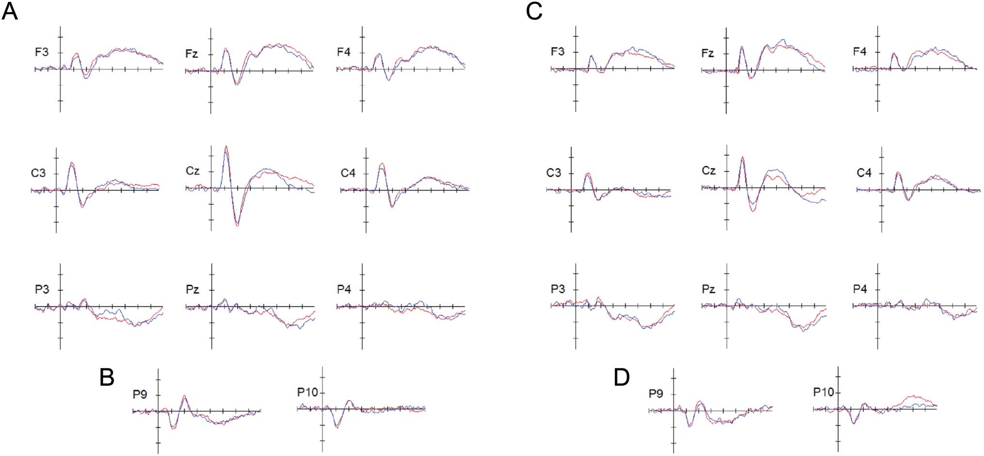 Going Beyond Rote Auditory Learning: Neural Patterns image