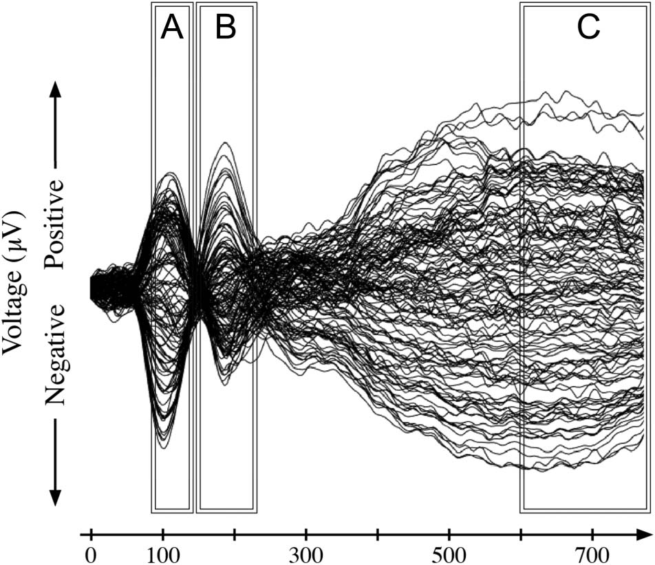 Going Beyond Rote Auditory Learning: Neural Patterns image