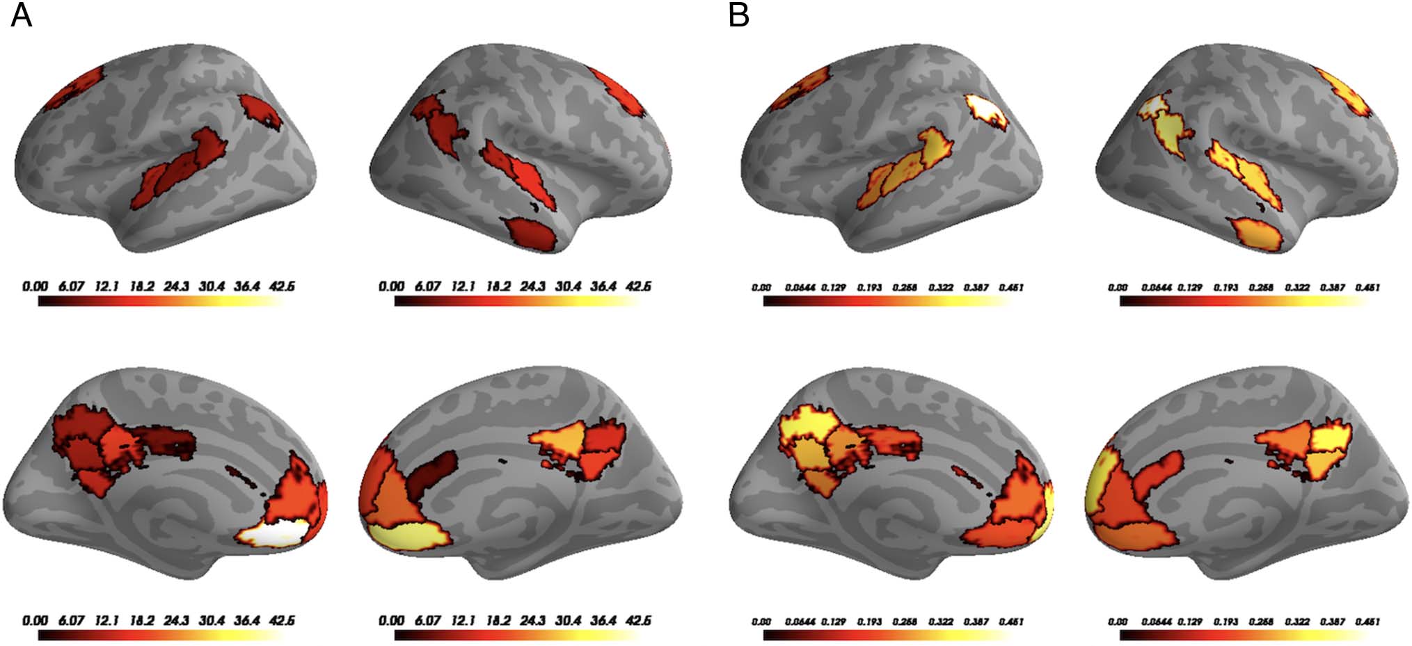 High-Order Areas and Auditory Cortex Both Represent image