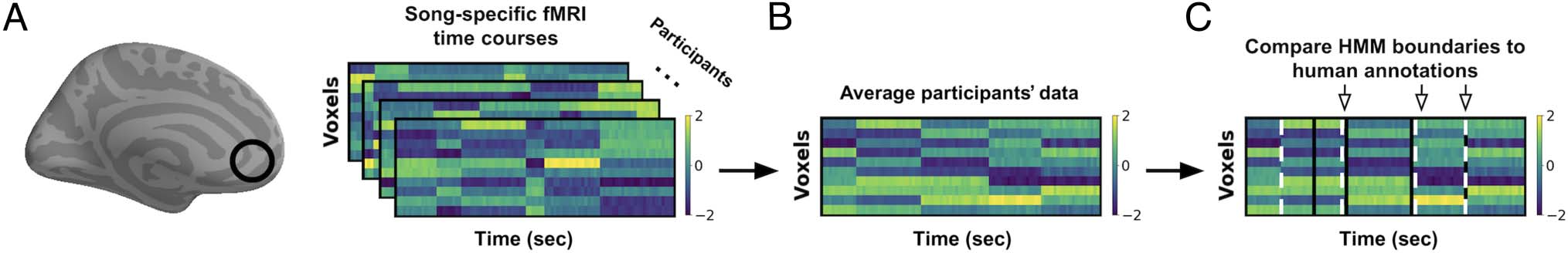 High-Order Areas and Auditory Cortex Both Represent image