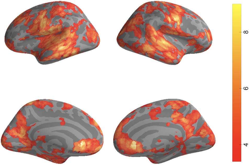 High-Order Areas and Auditory Cortex Both Represent image