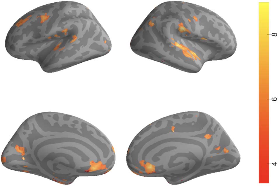 High-Order Areas and Auditory Cortex Both Represent image