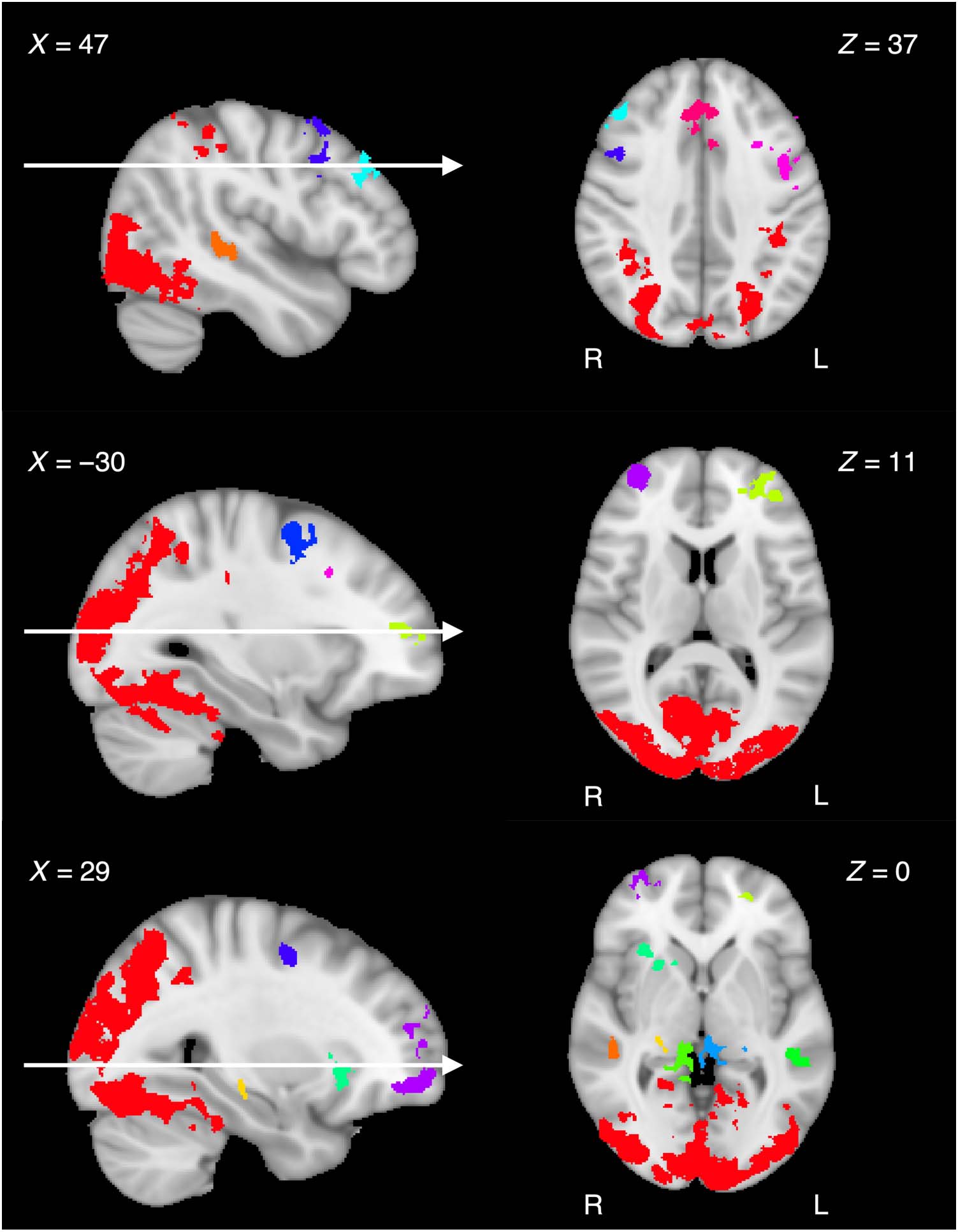 Distributed Neural Systems Support Flexible Attention image