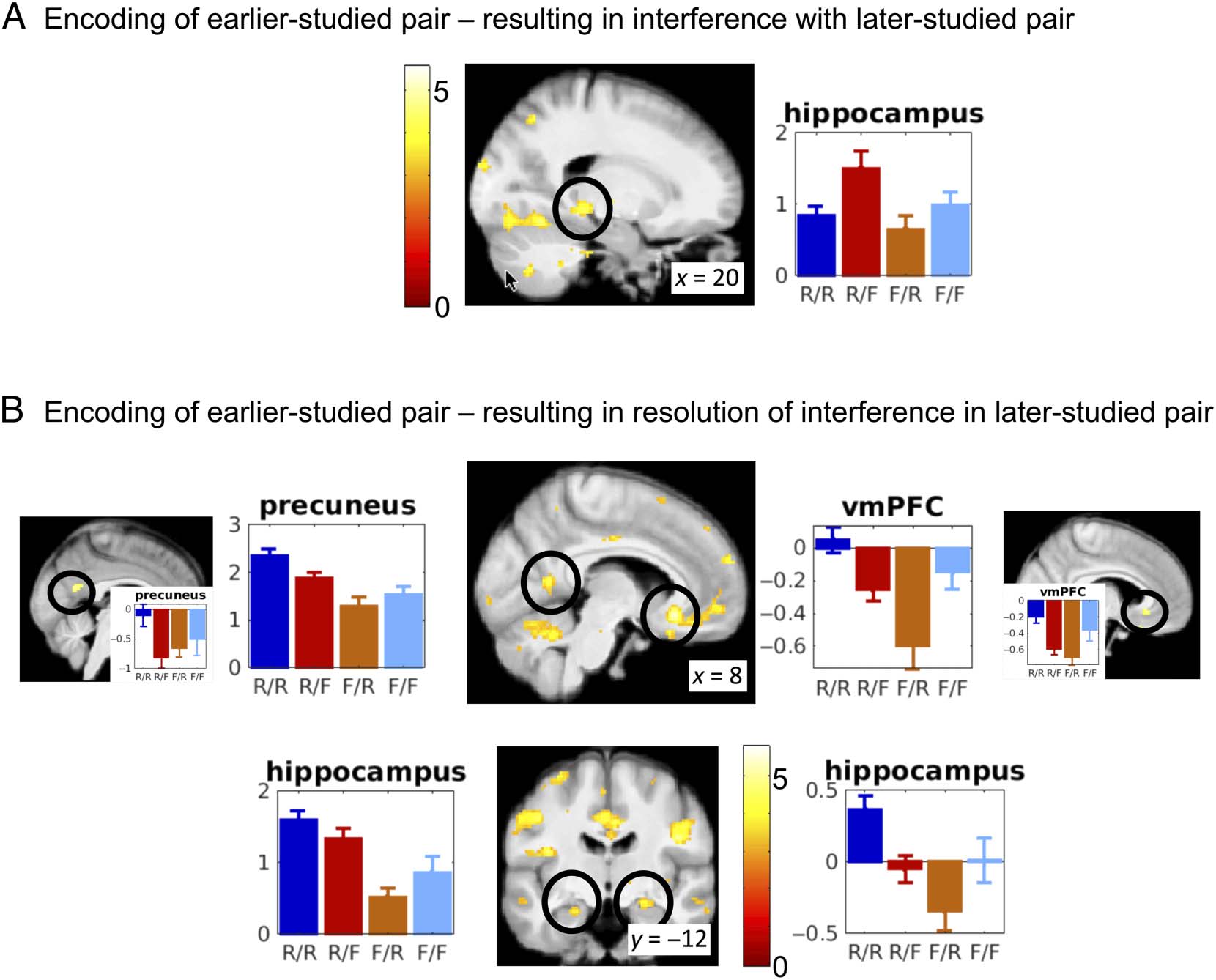 Competition between Associations in Memory image