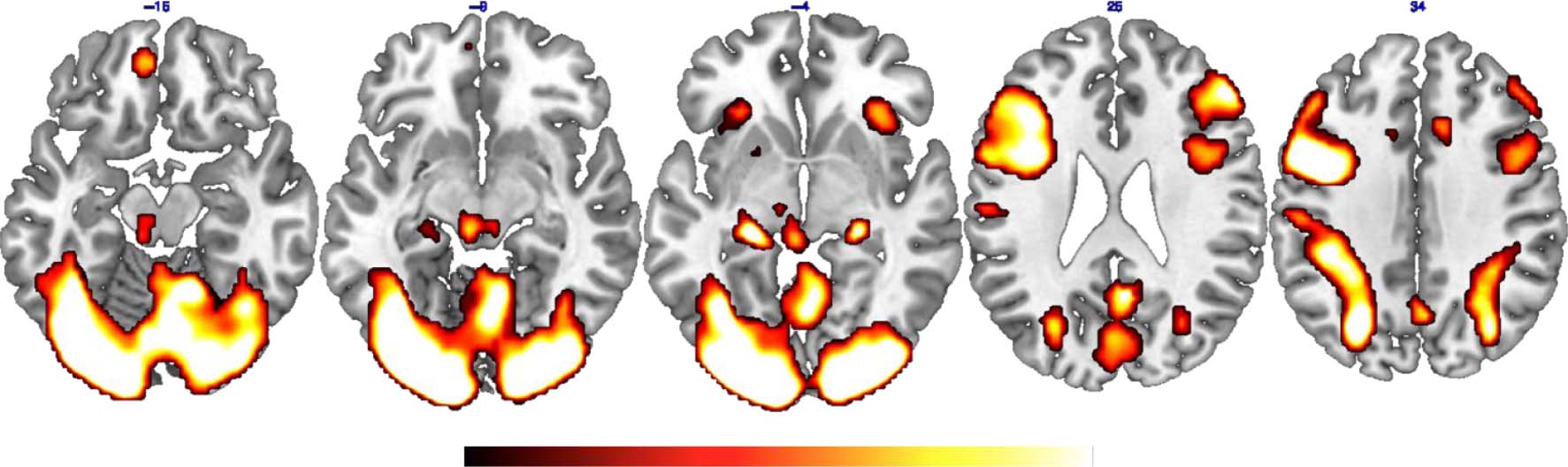 Temporal Organization of Episodic and Experience-near image