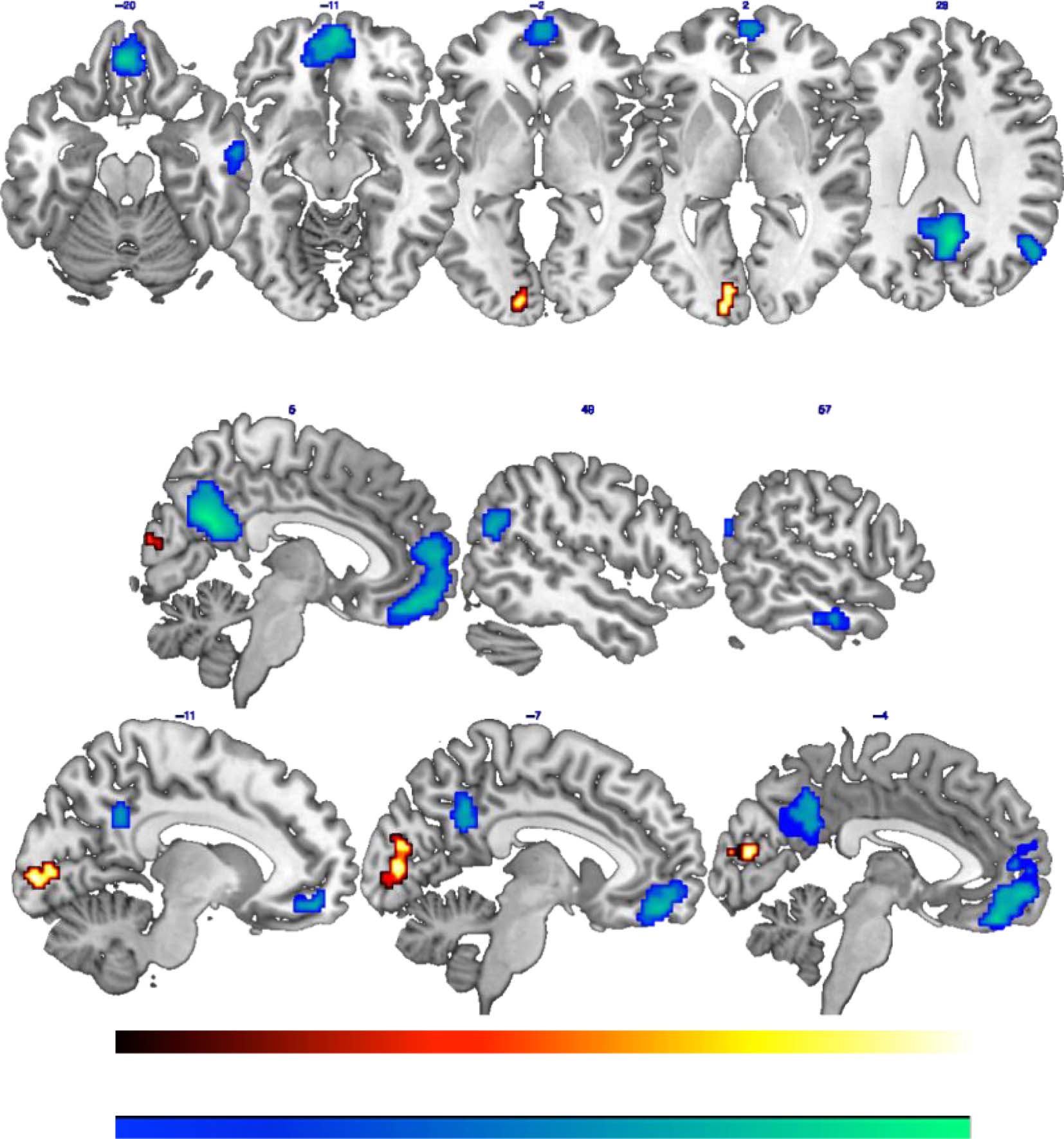 Temporal Organization of Episodic and Experience-near image