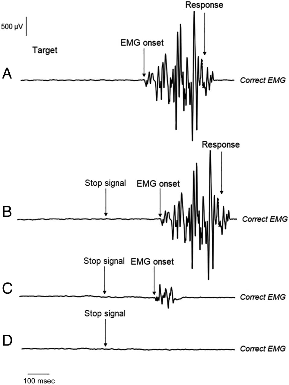 No me detengas ahora: Neural Underpinnings of Increased image